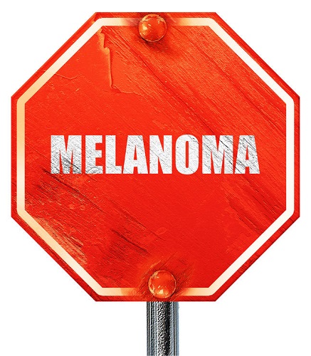 57144312 - melanoma, 3d rendering, a red stop sign